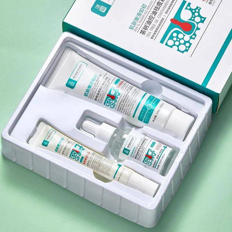 Herbal Acne Removal Face Cream - Zera