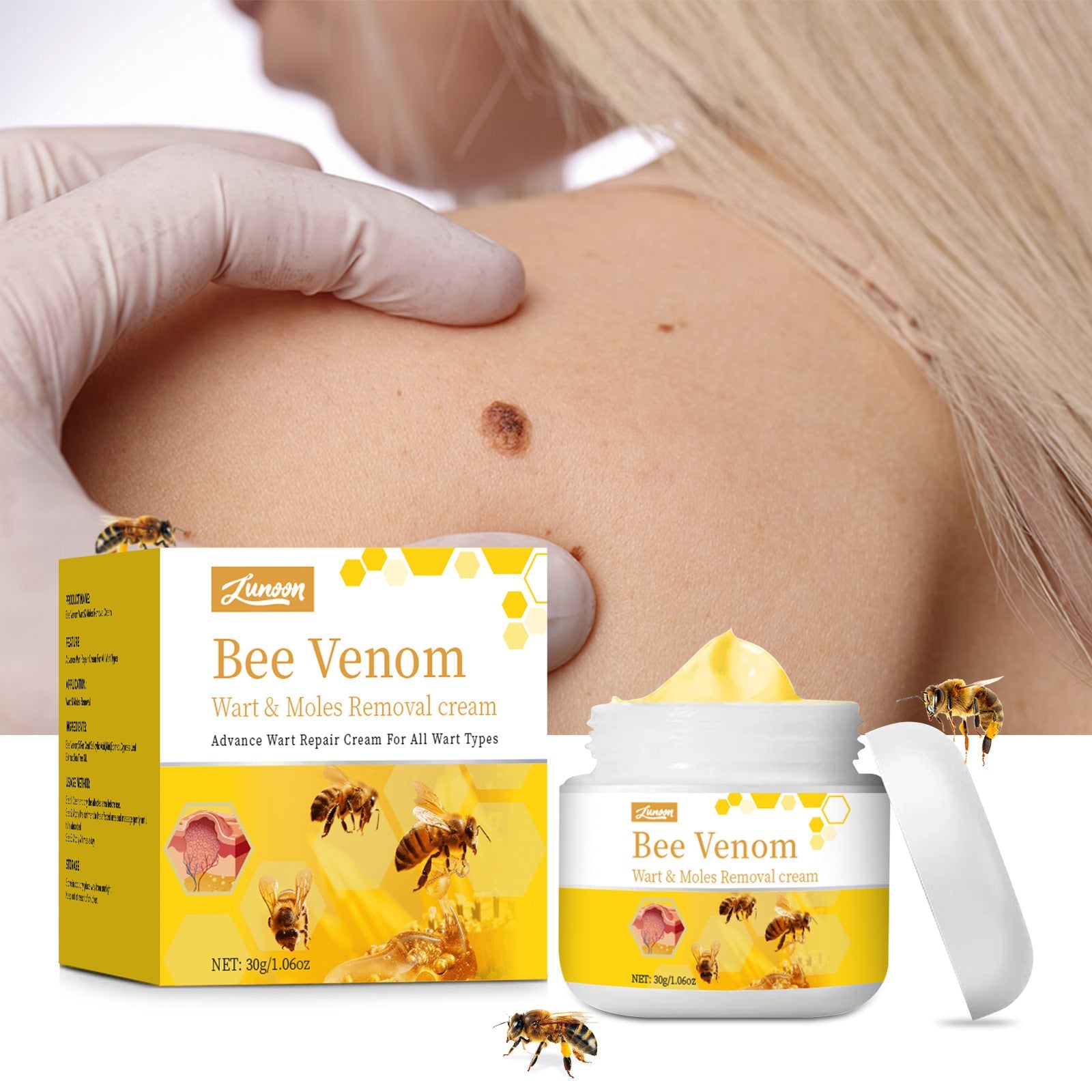 Bee  Wart Cream 30g Fade Skin
