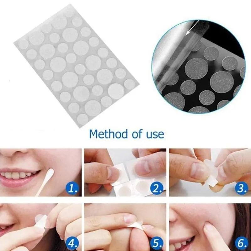 Face Spot Scar Care Treatment Stickers - Zera