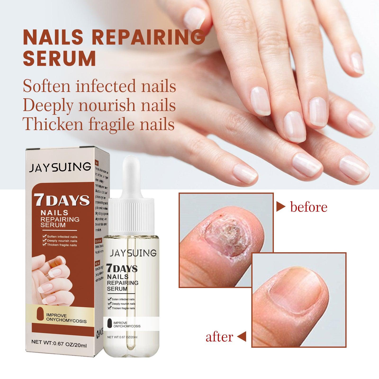 Repair Inlay Nail Thickening Type Dust Hand And Foot Nail Repair