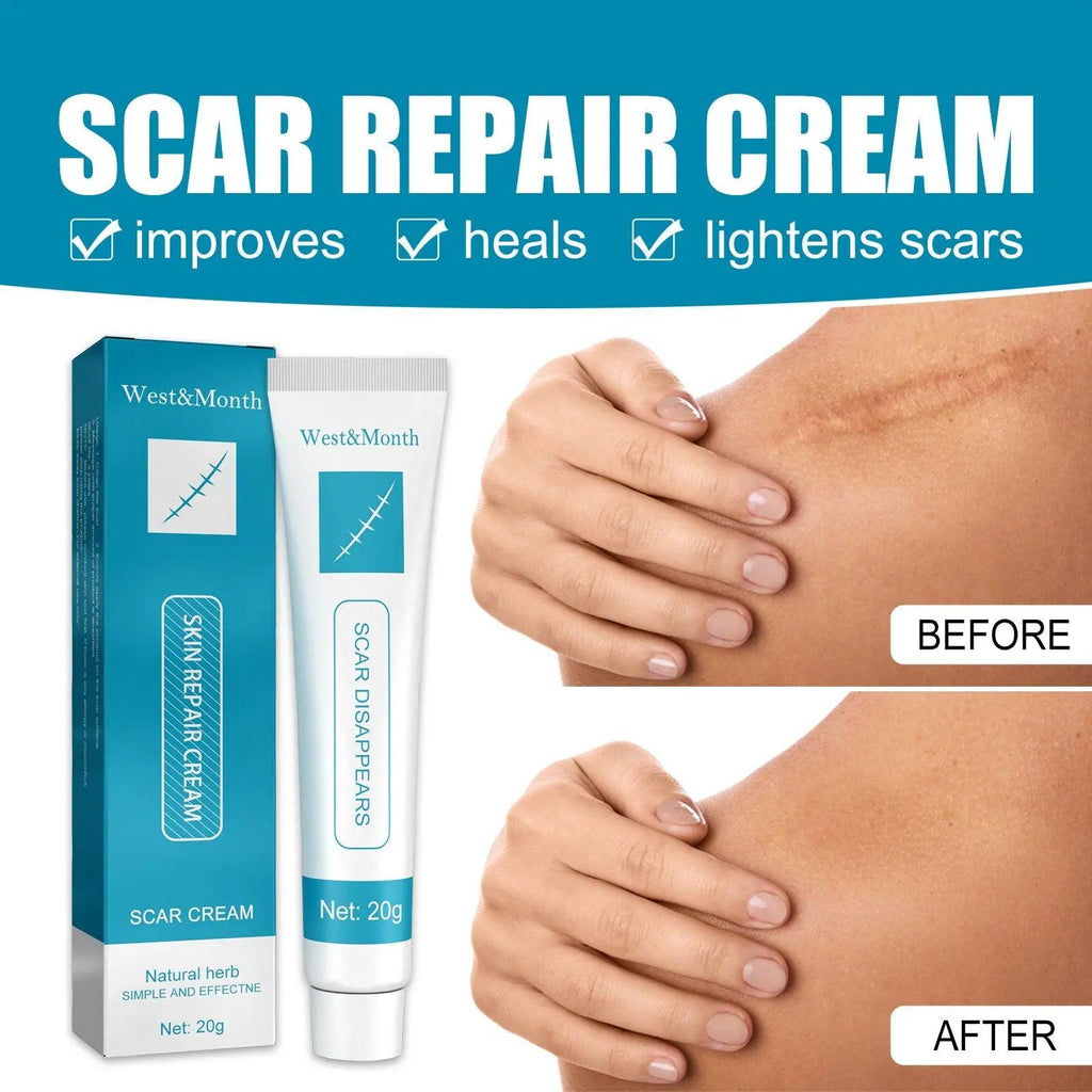 Scar Repair Cream Desalinates Old Scald Burns - BEAUTIRON