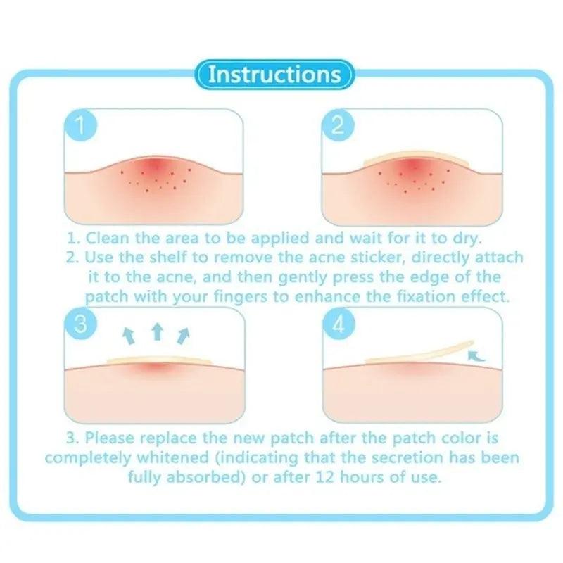 Face Spot Scar Care Treatment Stickers - Zera