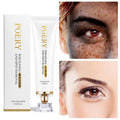 Whitening And Freckle Cream To Reduce Spots And Moisturizing - Zera