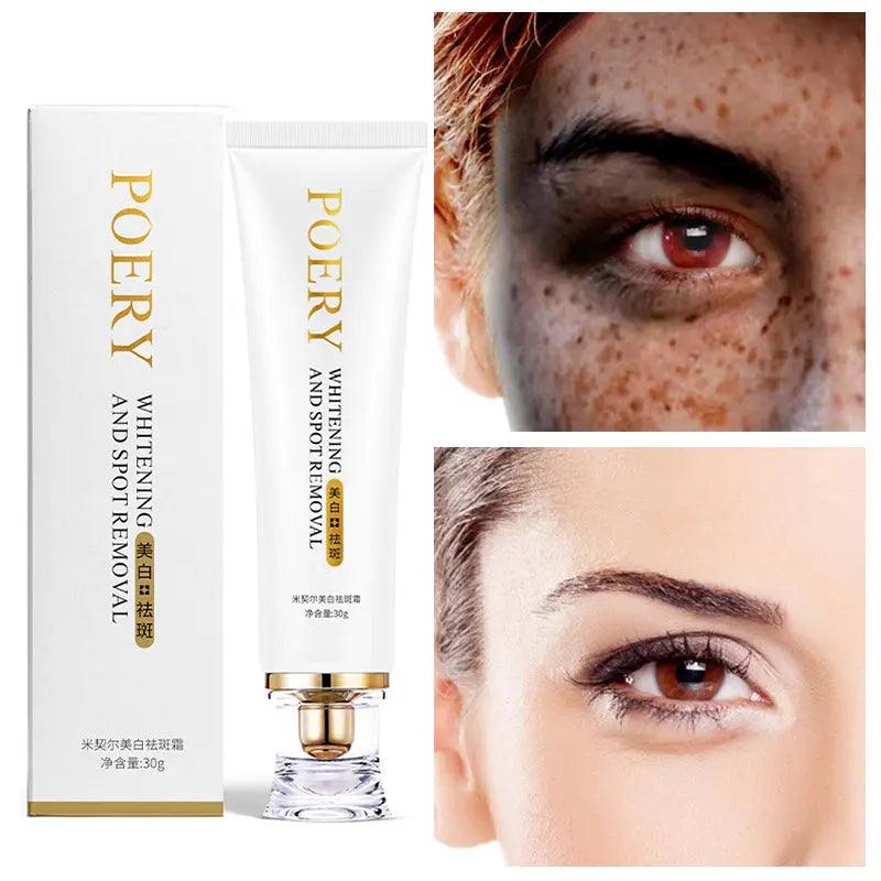 Whitening And Freckle Cream To Reduce Spots And Moisturizing - Zera