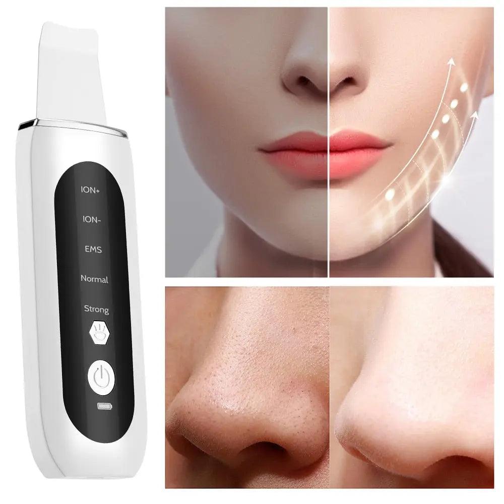Ultrasonic Face Skin Scrubber - Zera