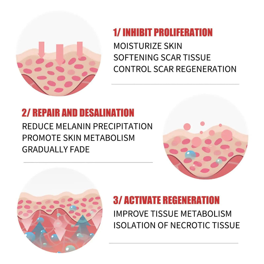 Scar Repair Cream Desalinates Old Scald Burns - BEAUTIRON