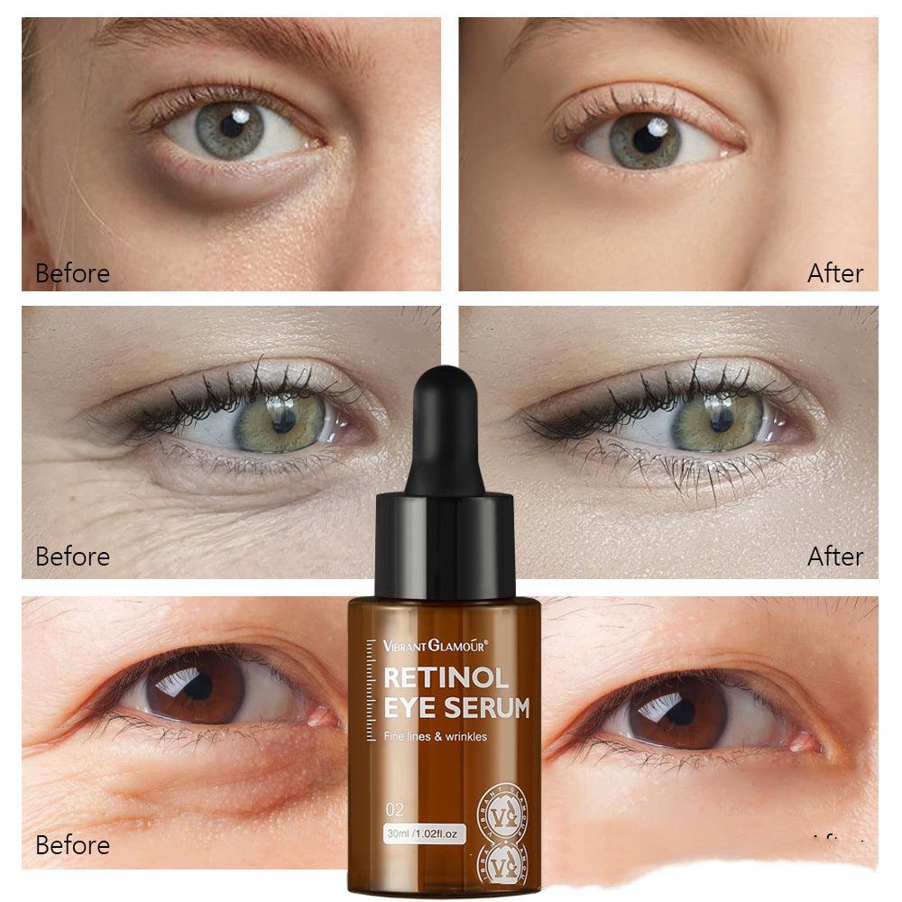Reduce Fine Lines Around The Eyes Moisturize