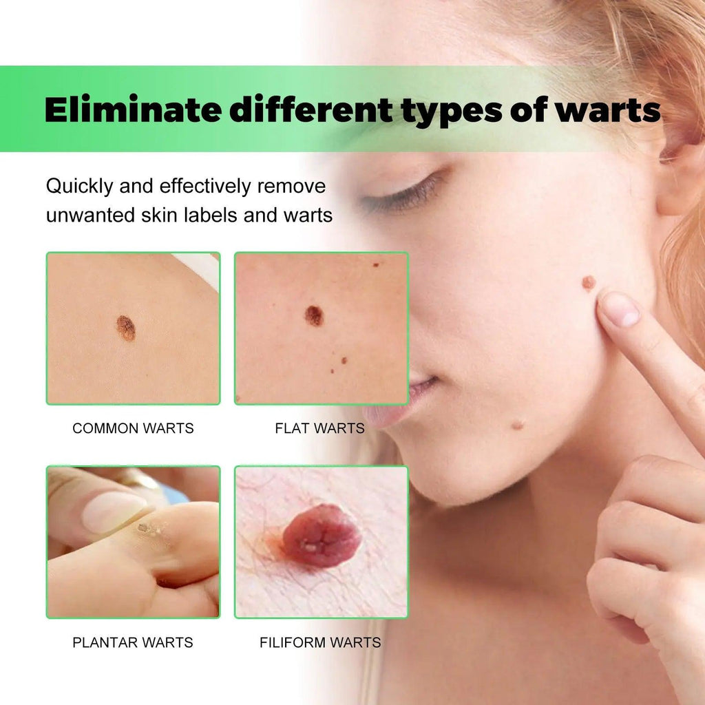 Mole Removal G Wart Grain Filamentous Wart Body Cleaning Soap - BEAUTIRON