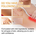Relieve Itching And Redness Neck Cream