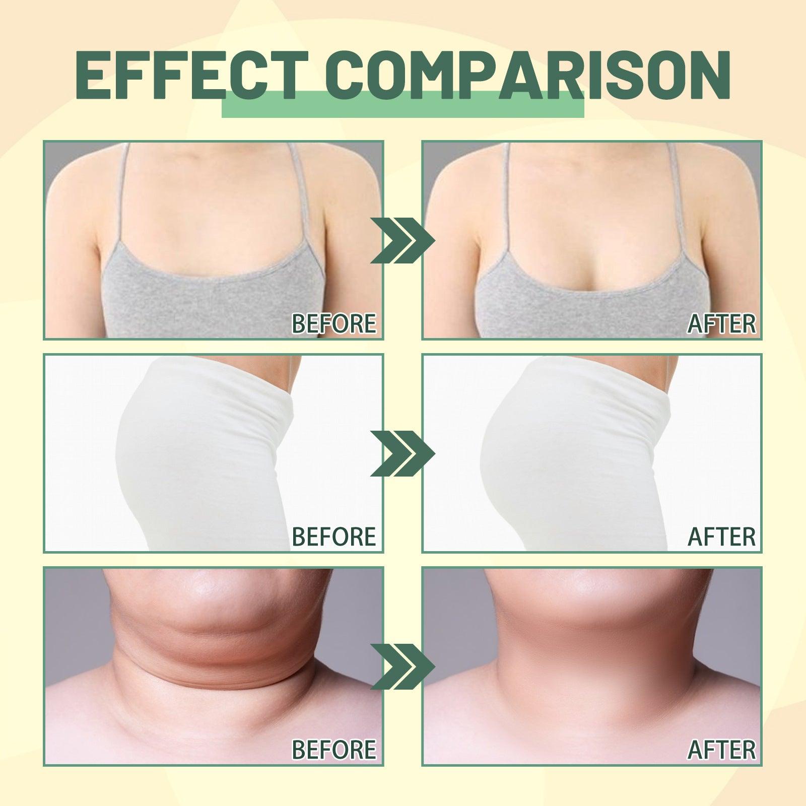 Therapeutic oil for body tightening, collagen massage, slimming and shaping the abdomen
