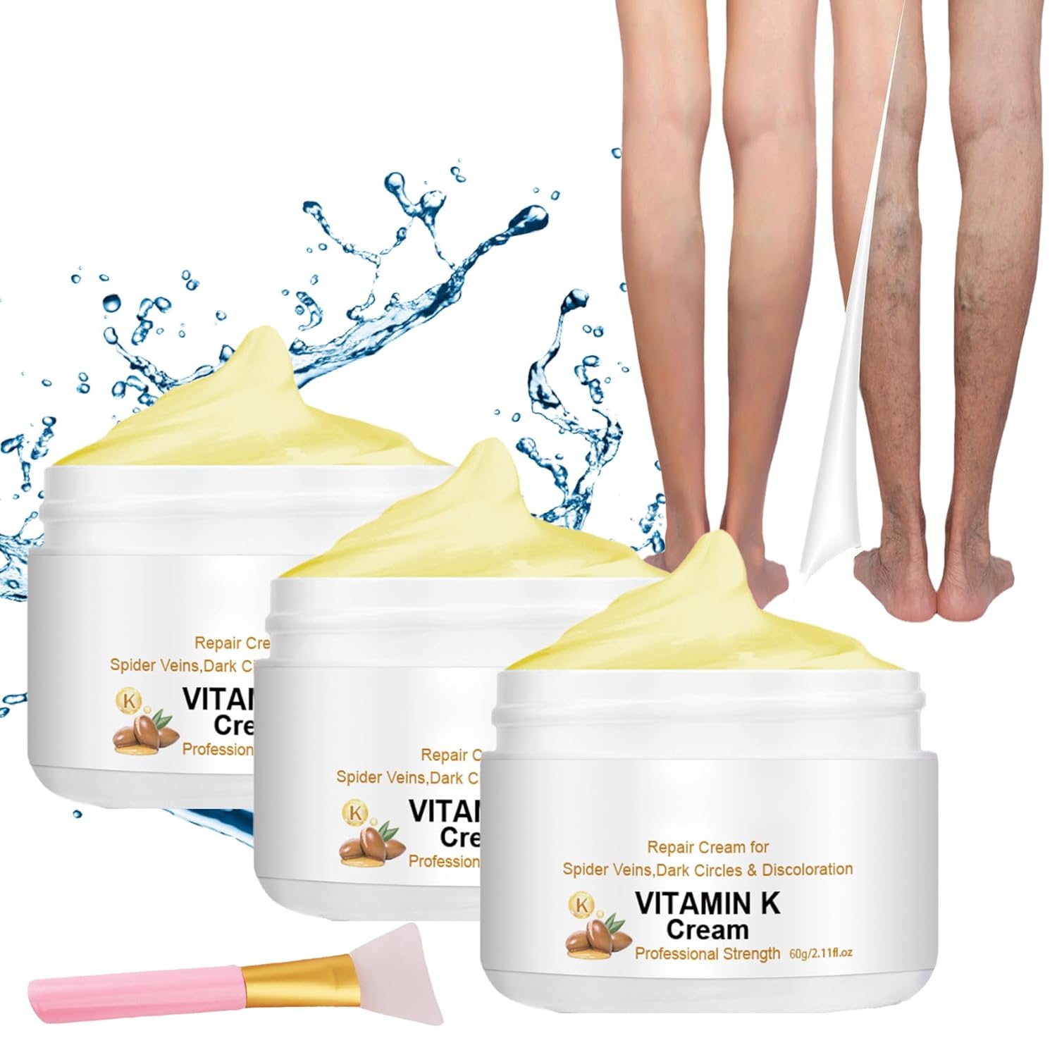 Varicose Veins Miracle Cream, Spider Varicose Veins