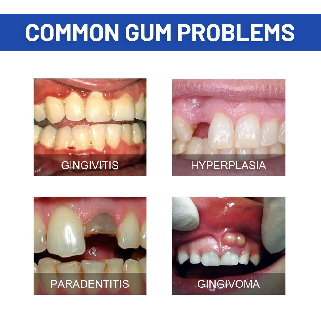 Repair Gel Relieves Swelling And Aching Of Gum