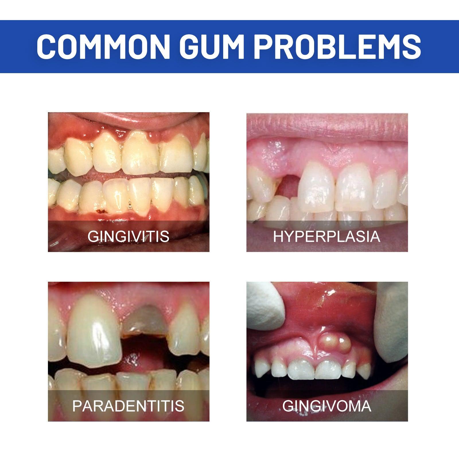 Repair Gel Relieves Swelling And Aching Of Gum