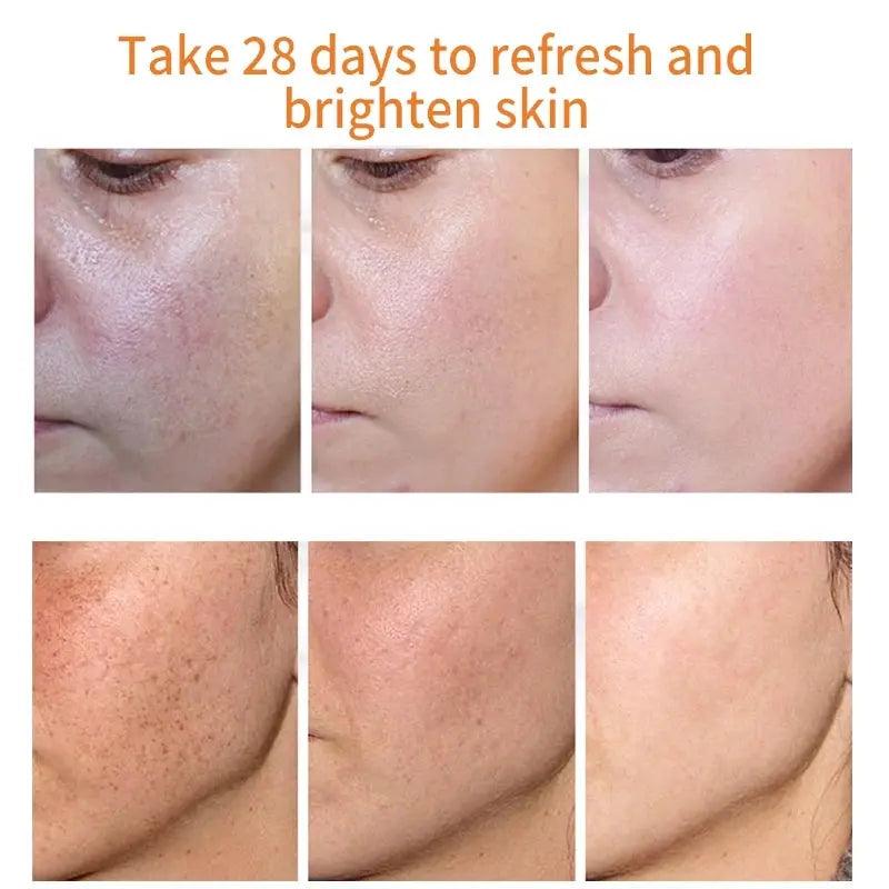 Whitening And Freckle Cream To Reduce Spots And Moisturizing - Zera