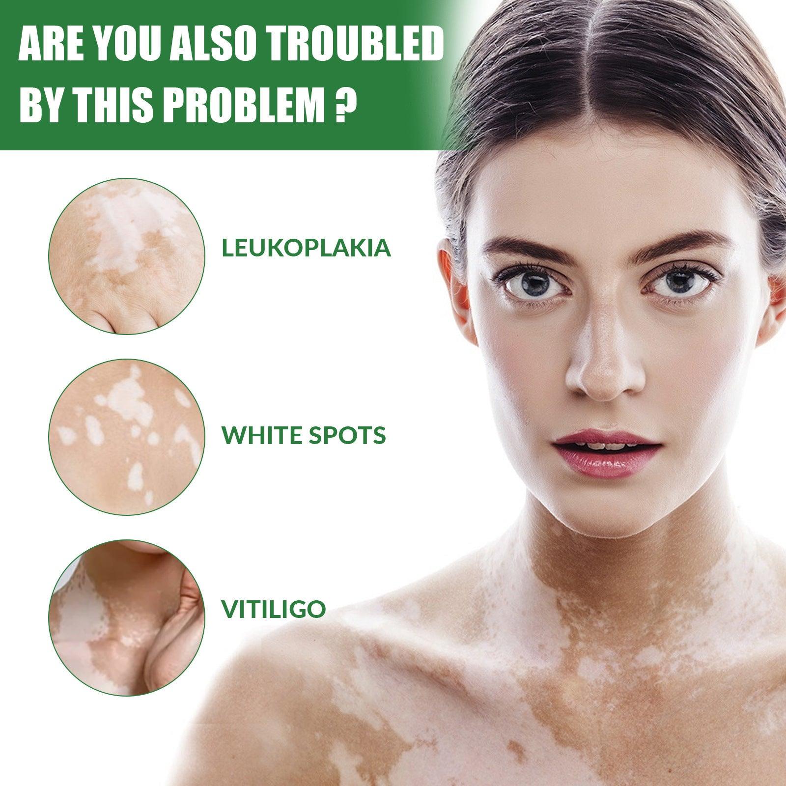 White Spot Repair Cream Melanin Repair Even Skin Color For External Use
