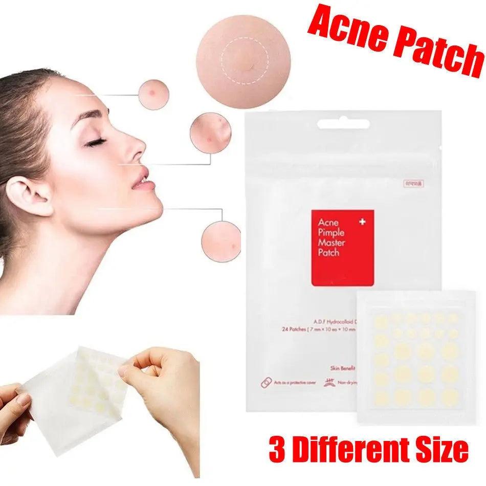 Face Spot Scar Care Treatment Stickers - Zera