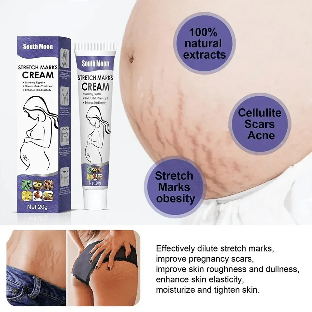 Stretch Mark Permanent Remover Stretch Mark Removal Cream White Stretch Mark Remover Stretch Mark Remover Free Shipping