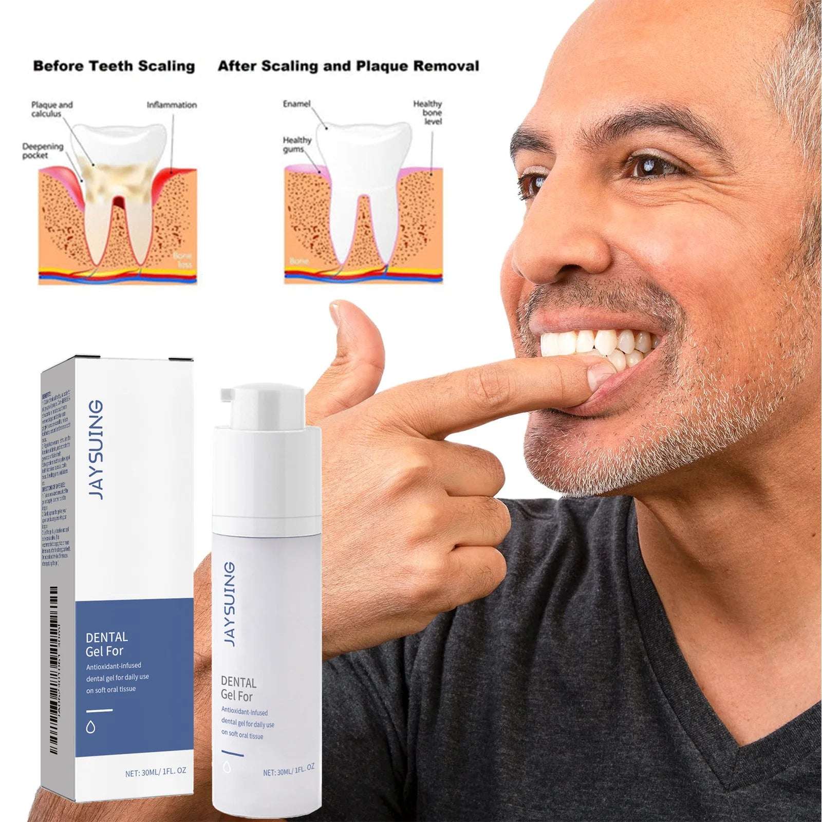 Teeth Cleaning Gel Removes Plaque Stains Oral Hygiene Fresh Breath Yellow Tartar Removal Brighten Dental Tooth Whitening Gel