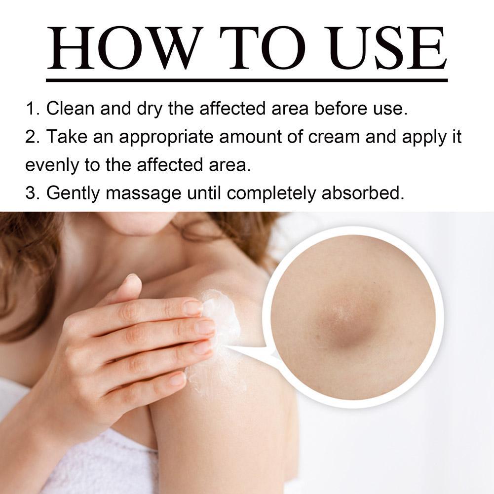 1pc Lipoma Removal Herbal Cream Body Cream Dissolving Fat Easy To Use Herbal Lipoma Removal Cream