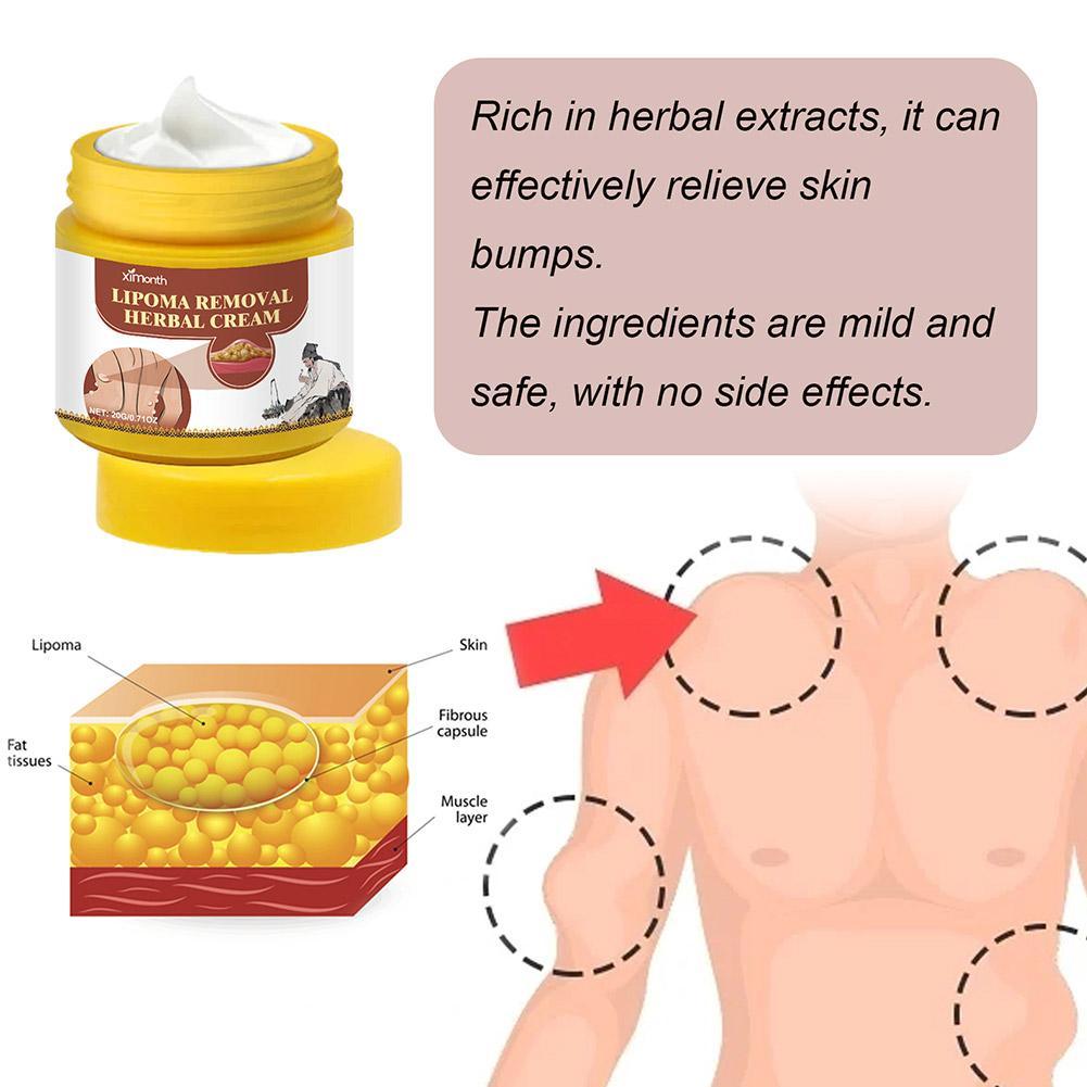 1pc Lipoma Removal Herbal Cream Body Cream Dissolving Fat Easy To Use Herbal Lipoma Removal Cream