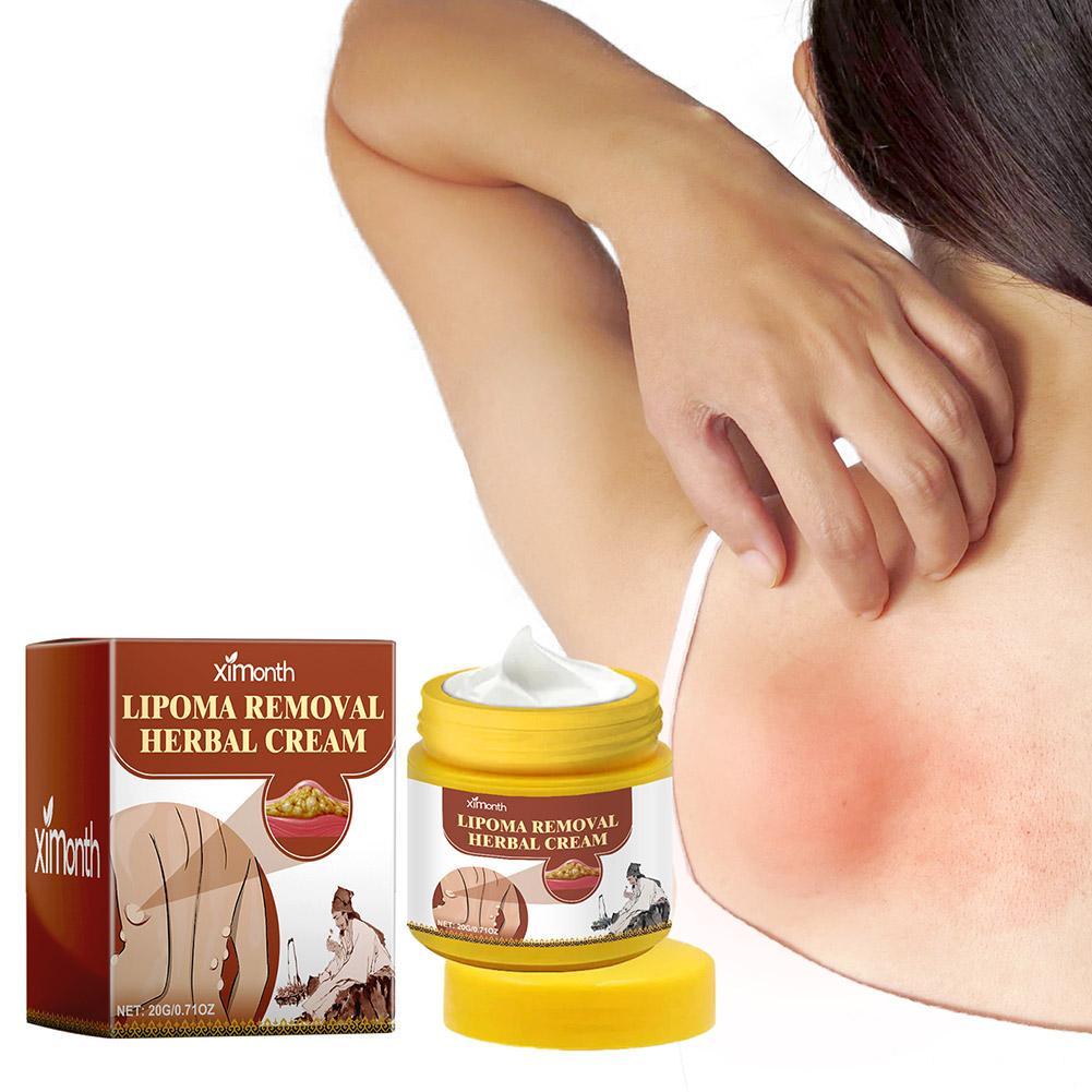 1pc Lipoma Removal Herbal Cream Body Cream Dissolving Fat Easy To Use Herbal Lipoma Removal Cream