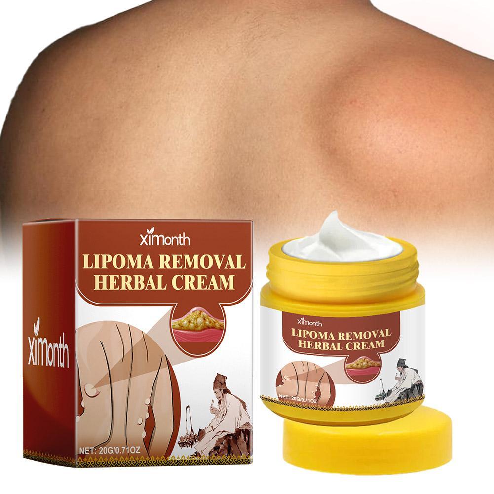 1pc Lipoma Removal Herbal Cream Body Cream Dissolving Fat Easy To Use Herbal Lipoma Removal Cream