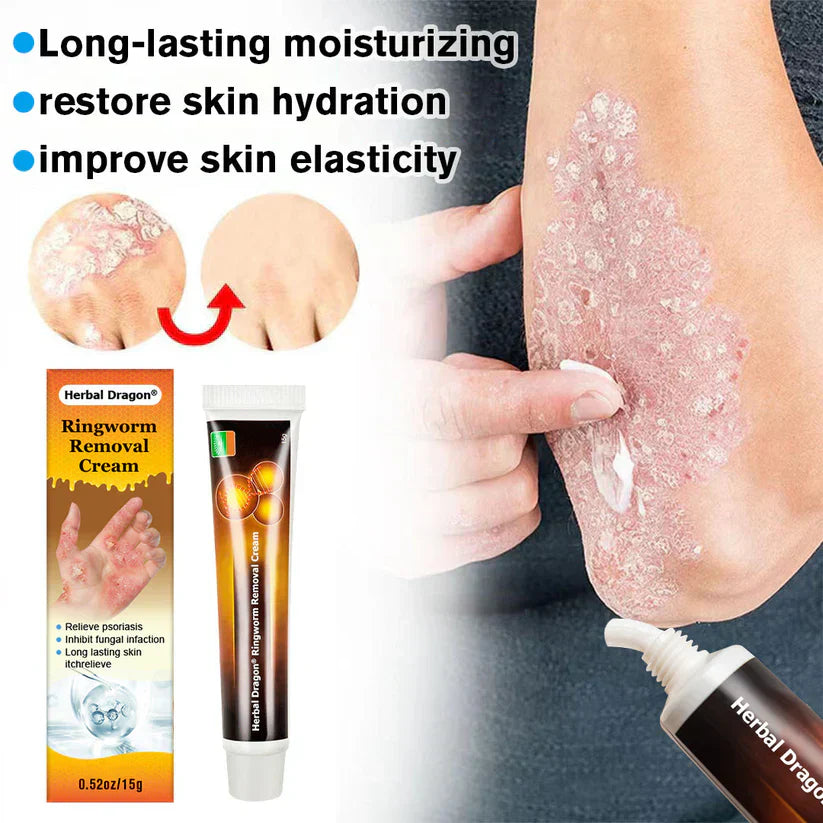 Anti Fungal cream