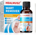 Wart remover cream
