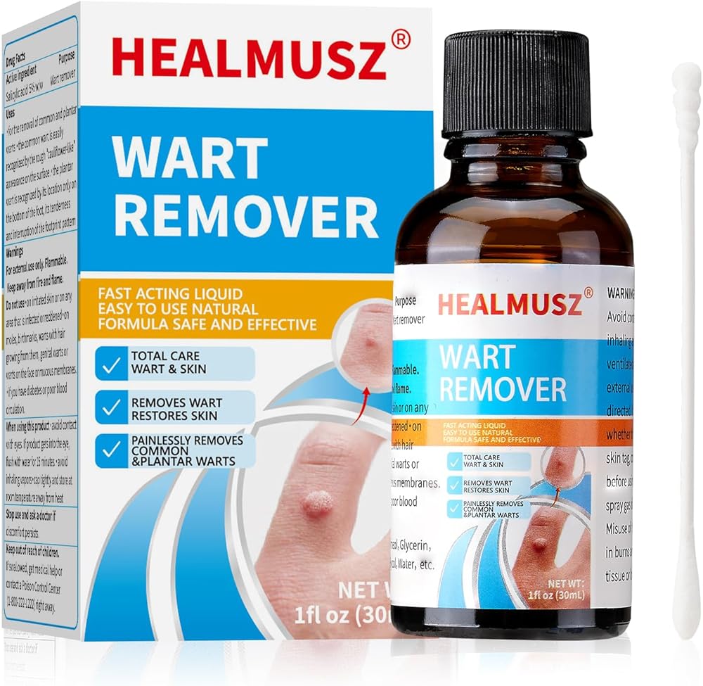 Wart remover cream