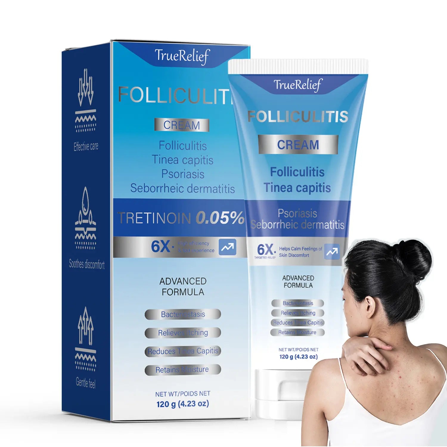 Acne treatment cream: effective treatment for folliculitis of the scalp, face and body