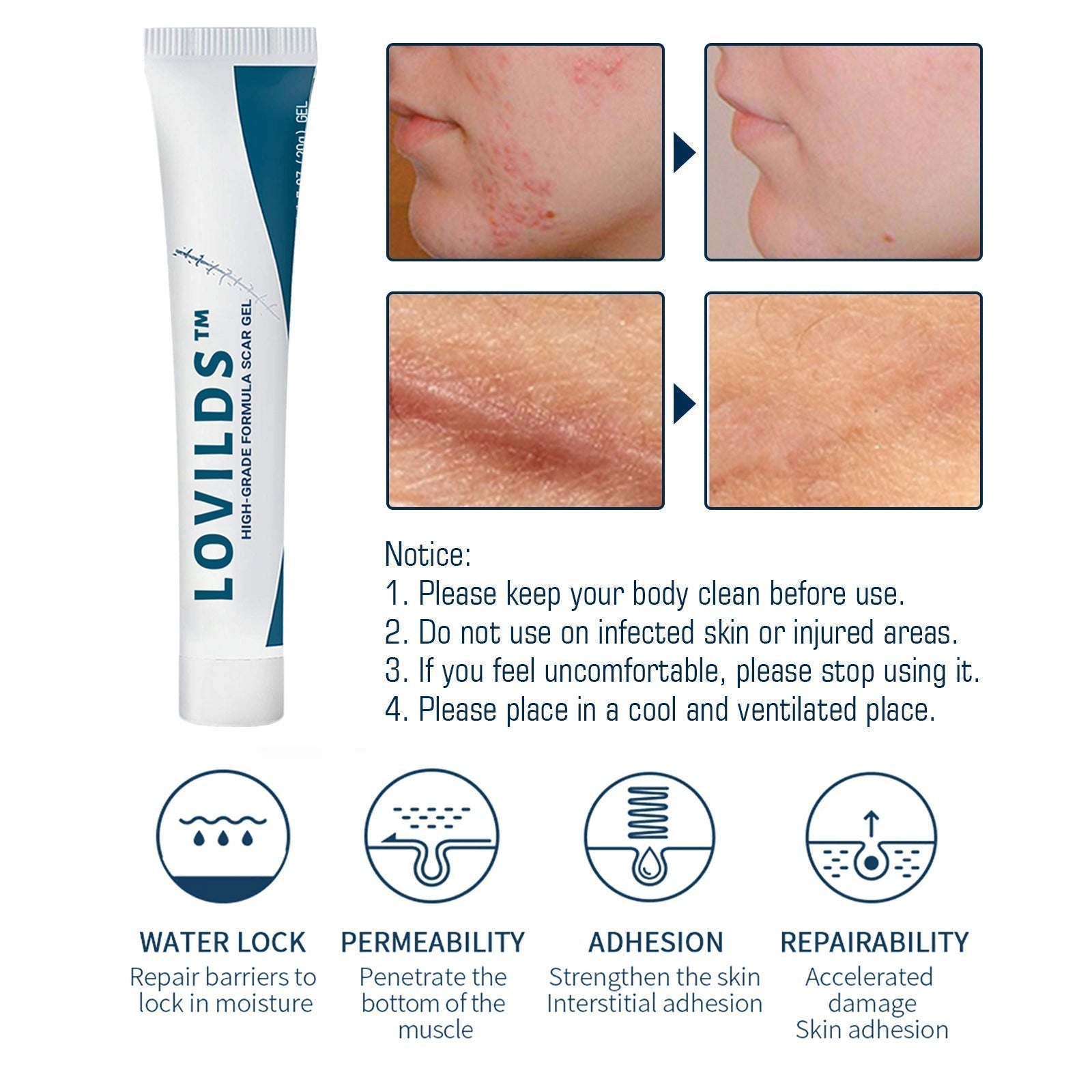 scar cream remover