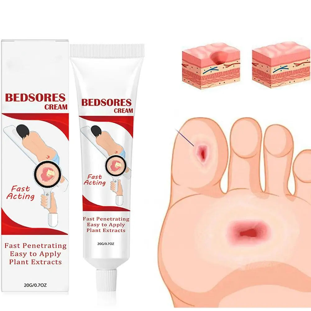 Bedsore Treatment Cream Pressure Sore Ulcer Skin Rot Necrotic Repair Relief Ointment Bed Sore Wound Healing Decubitus Feet Care