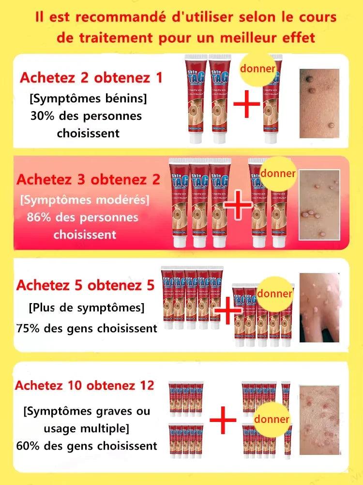 Wart, Freckle, Skin Tag, Mole, Dark Spot Removal Eyelift