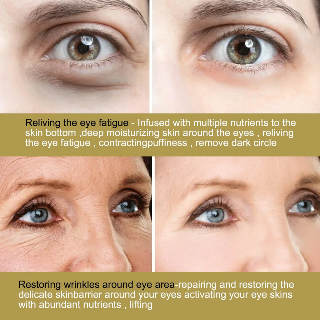 Niacinamide Anti-wrinkle Eye Mask, Dark Circles and Eye Bags Removal, Moisturizing and Nourishing Eye Skin Care Products