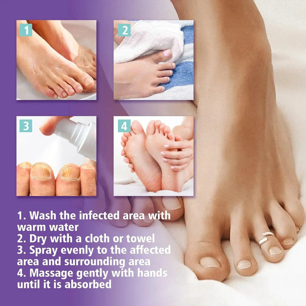 Onychomycosis Repair Spray Nail Fungus Treatment Hand Foot Soft Nail Ingrowing Thickening Nail Cleaning Care Hongos Uñas Pies