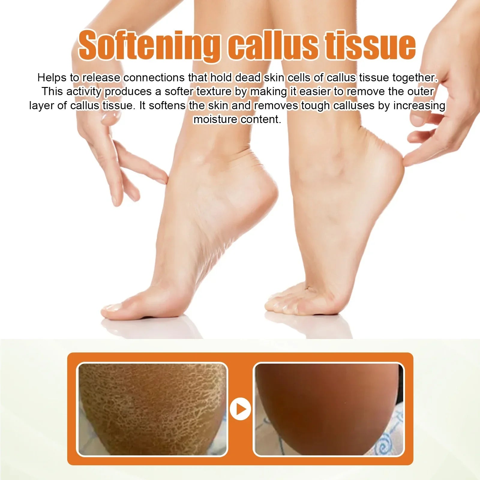 30ml Skin Remover Heel Dry Cracked Blister Repairing Pedicure Exfoliating Nourishing Foot Care Foot Peeling Spray Callus Dead
