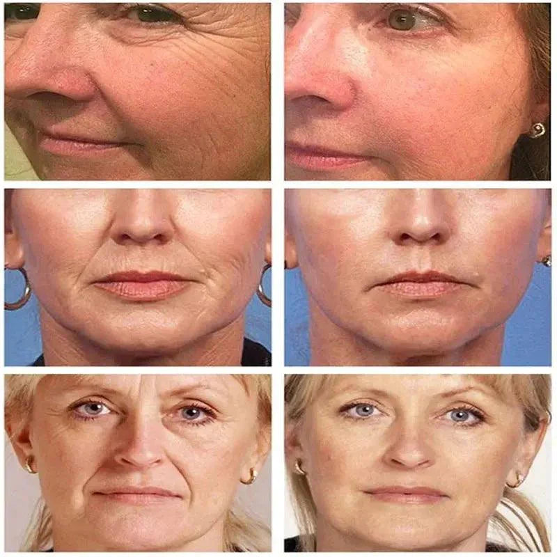 Retinol Anti Aging Remove Wrinkles Serum Firm Facial Essence Fade Eye Fine Line Moisturizing Lift Brighten Face Skin Care Beauty - BEAUTIRON