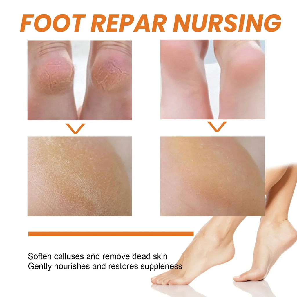 30ml Skin Remover Heel Dry Cracked Blister Repairing Pedicure Exfoliating Nourishing Foot Care Foot Peeling Spray Callus Dead