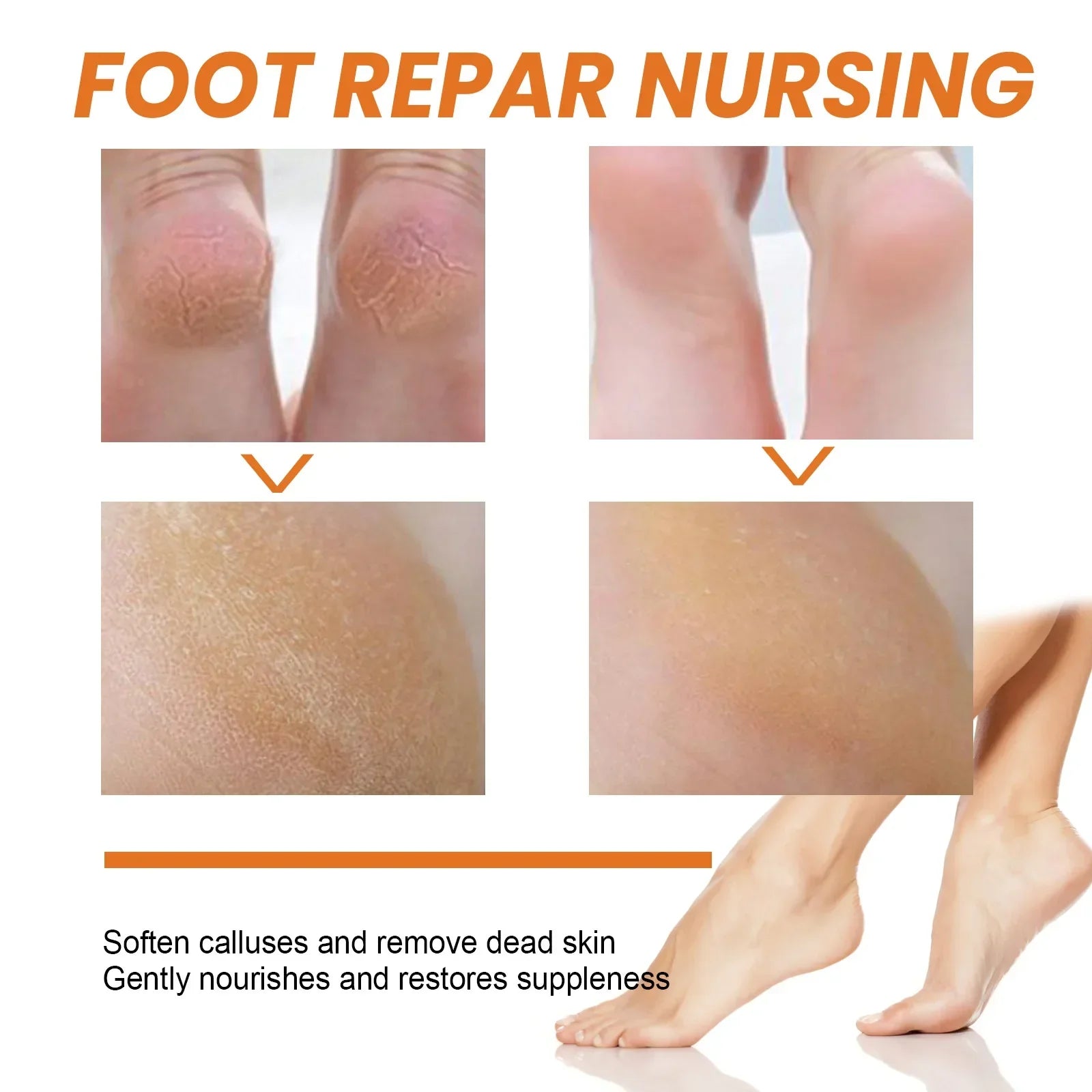 30ml Skin Remover Heel Dry Cracked Blister Repairing Pedicure Exfoliating Nourishing Foot Care Foot Peeling Spray Callus Dead