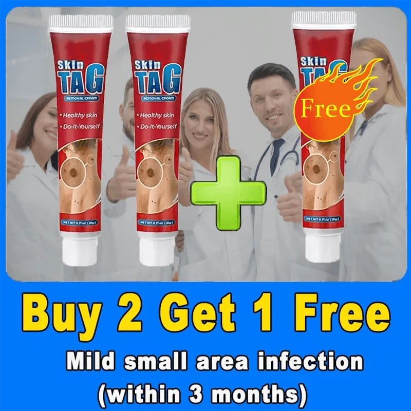 Wart, Freckle, Skin Tag, Mole, Dark Spot Removal Eyelift