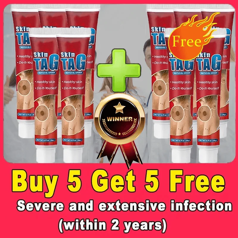Wart, Freckle, Skin Tag, Mole, Dark Spot Removal Eyelift