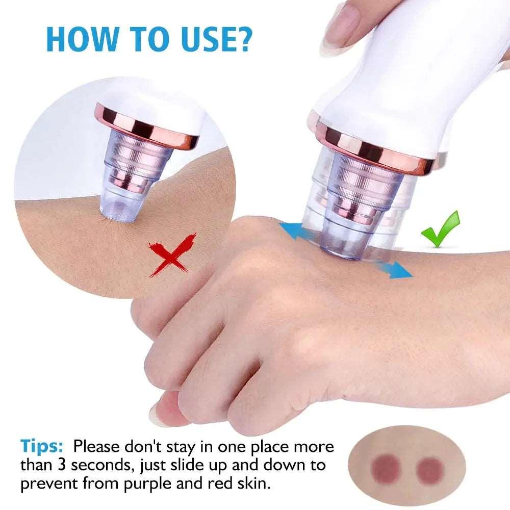 Blackhead Remover Skin Care Face Clean Pore Vacuum Acne Pimple Removal Suction Facial Diamond Dermabrasion Tool Care - BEAUTIRON