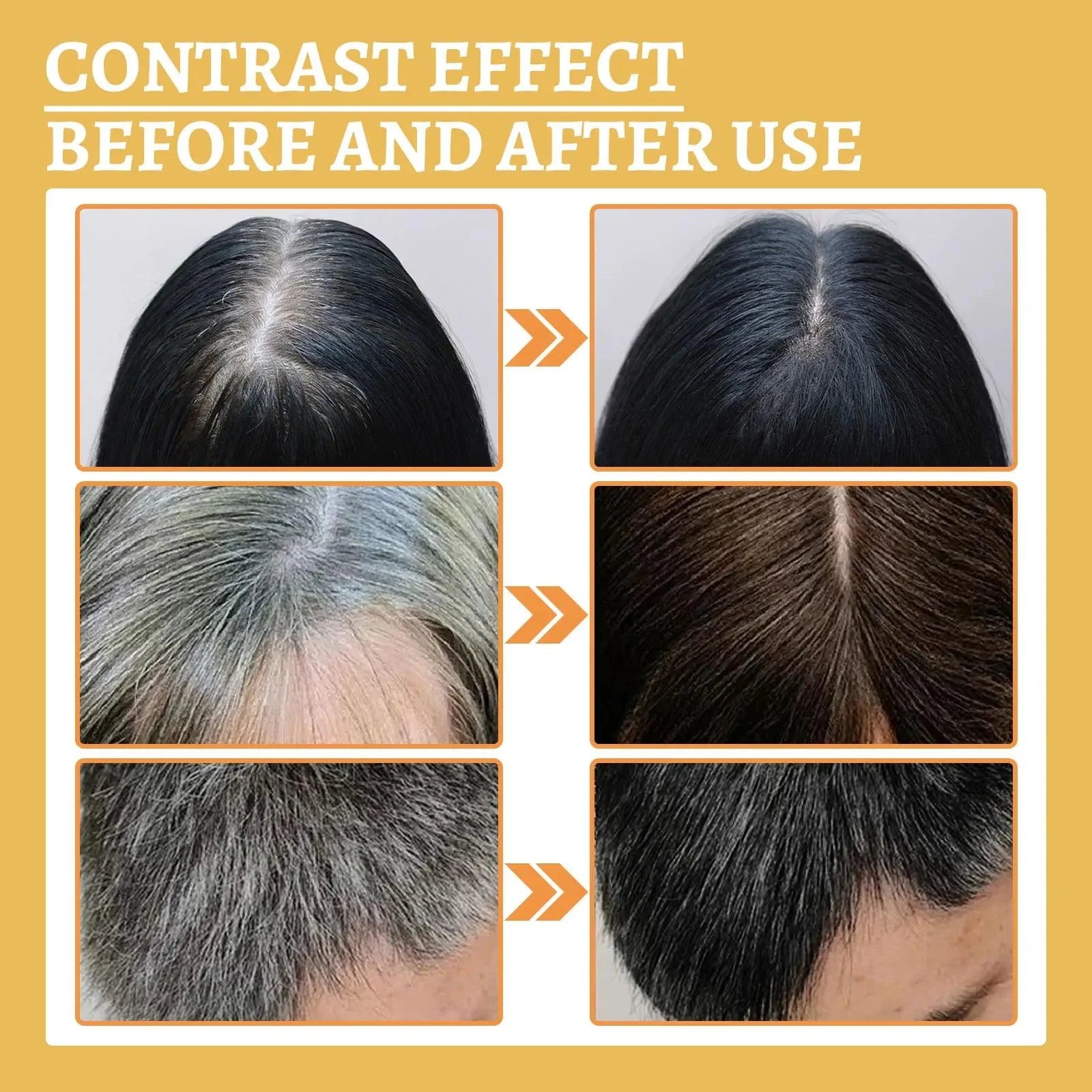 Premium Reishi Hair Shampoo For Gray Hair,Support Follicle And Hair Health,Hair Care And Nourishing Moisturizing Shampoo Essence