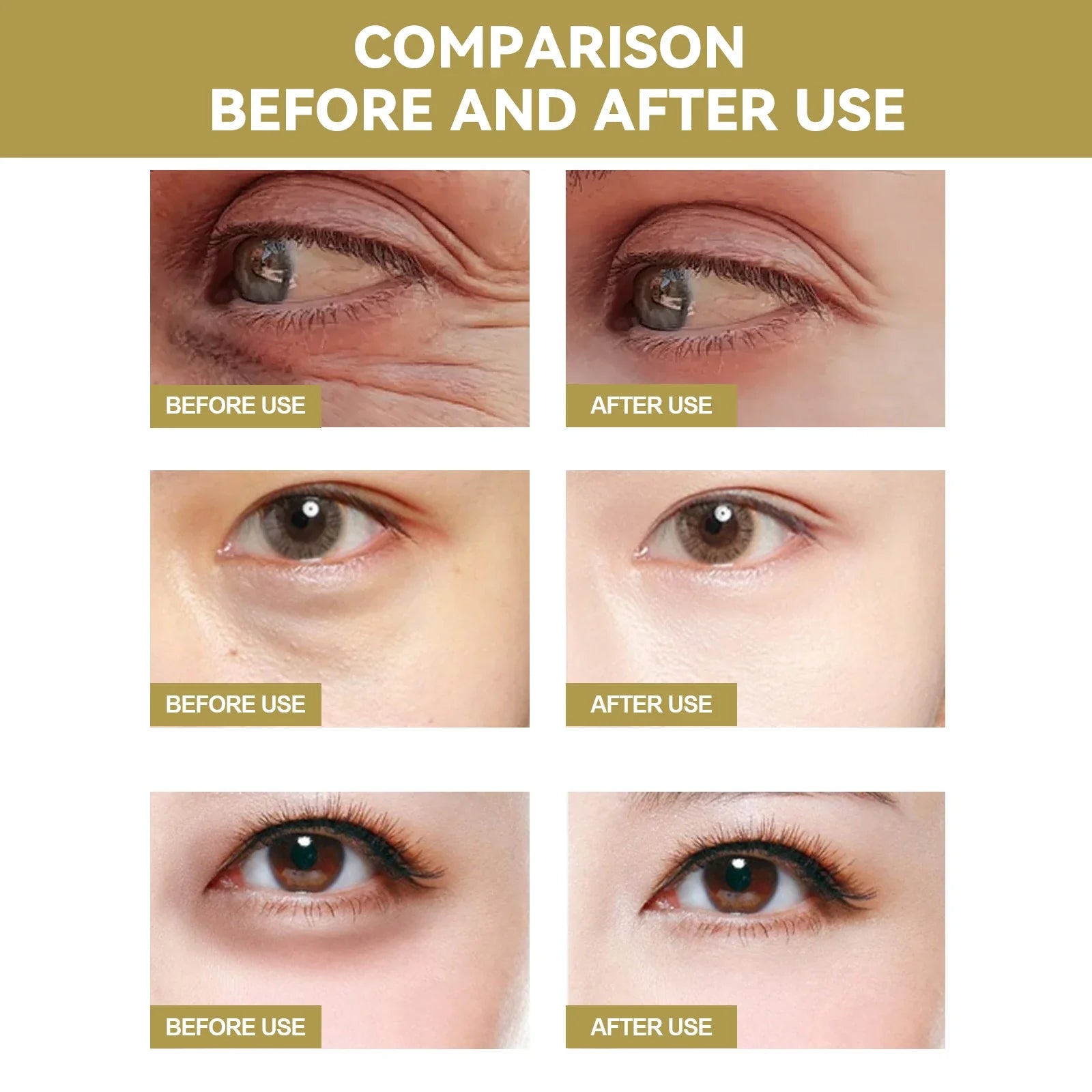 Niacinamide Anti-wrinkle Eye Mask, Dark Circles and Eye Bags Removal, Moisturizing and Nourishing Eye Skin Care Products