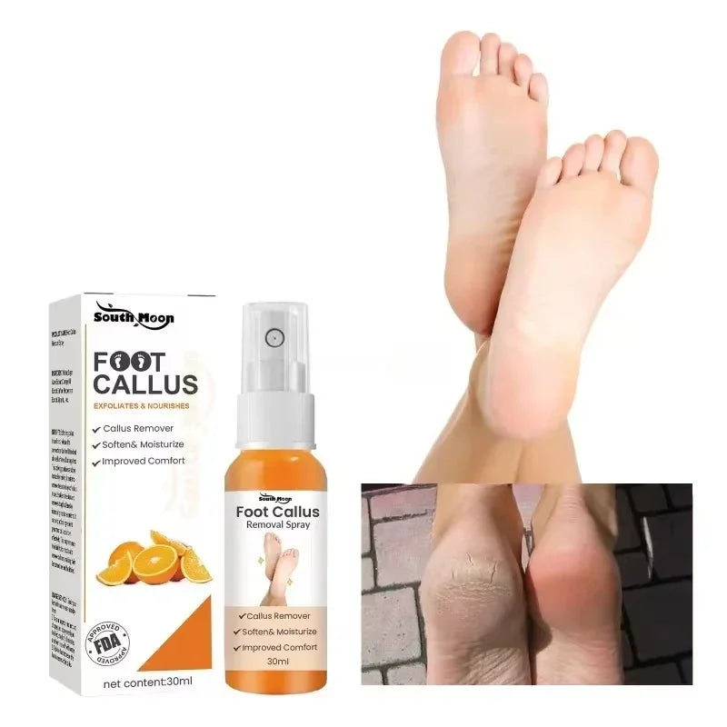 30ml Skin Remover Heel Dry Cracked Blister Repairing Pedicure Exfoliating Nourishing Foot Care Foot Peeling Spray Callus Dead