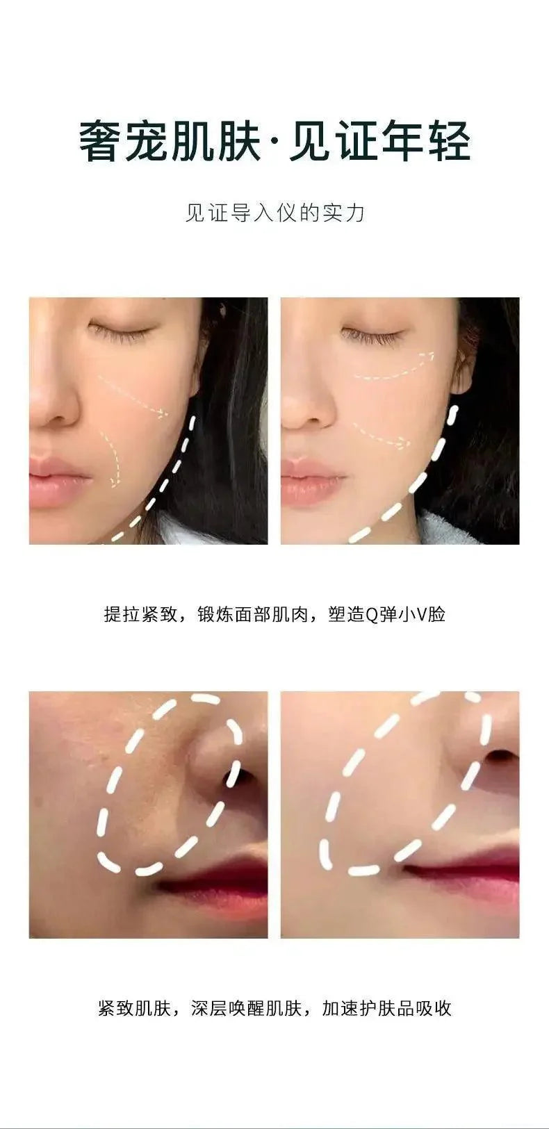 Electric Facial Beauty Devices Face Lifting Anti Wrinkle Facial Eye Massage with Face Cream Introducer Skin Rejuvenation Care