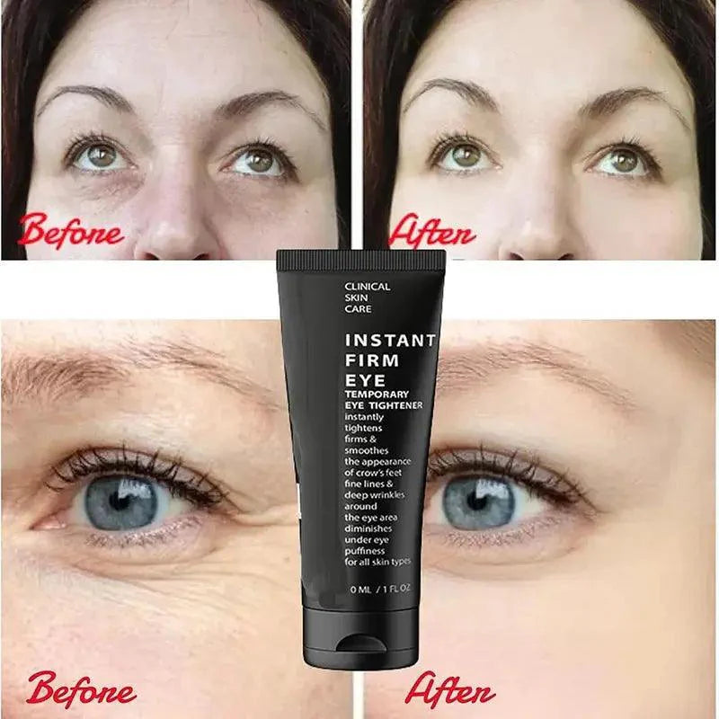 30ml CËLYN Instant Firm Eye Cream Eye Lifting Eye Bag Removal Wrinkle Removal Dark Circle Remover Eyes Skin Beauty Care - BEAUTIRON