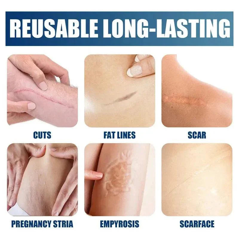 100% Silicone Scar Removal Cream Gel Burn Surgical Scar Cesarean Scar Repairing Stretch Marks Whitening Pigmentation Corrector - BEAUTIRON