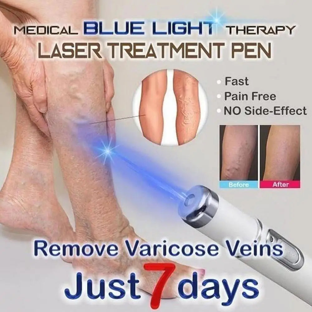 Skin Tag Removal Pen, Mole And Wart Removal Pen High-quality Anti Swelling Vessel Bulge Pain Blood Circulation