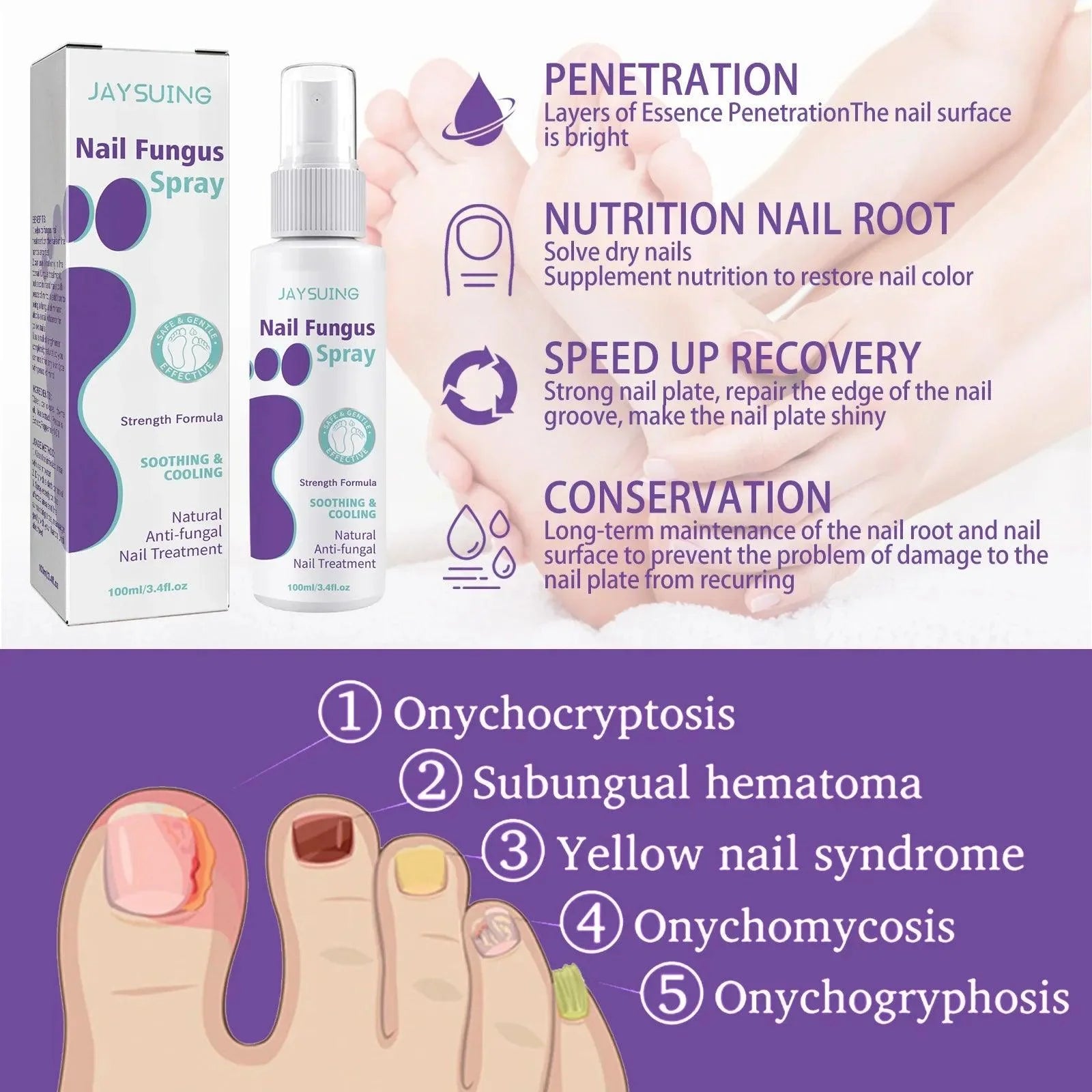 Onychomycosis Repair Spray Nail Fungus Treatment Hand Foot Soft Nail Ingrowing Thickening Nail Cleaning Care Hongos Uñas Pies